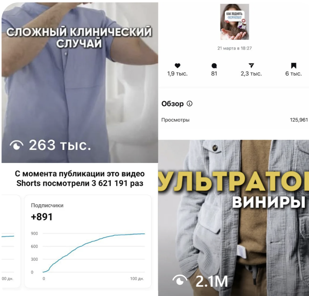 Статистика: 2.1M просмотров на виниры